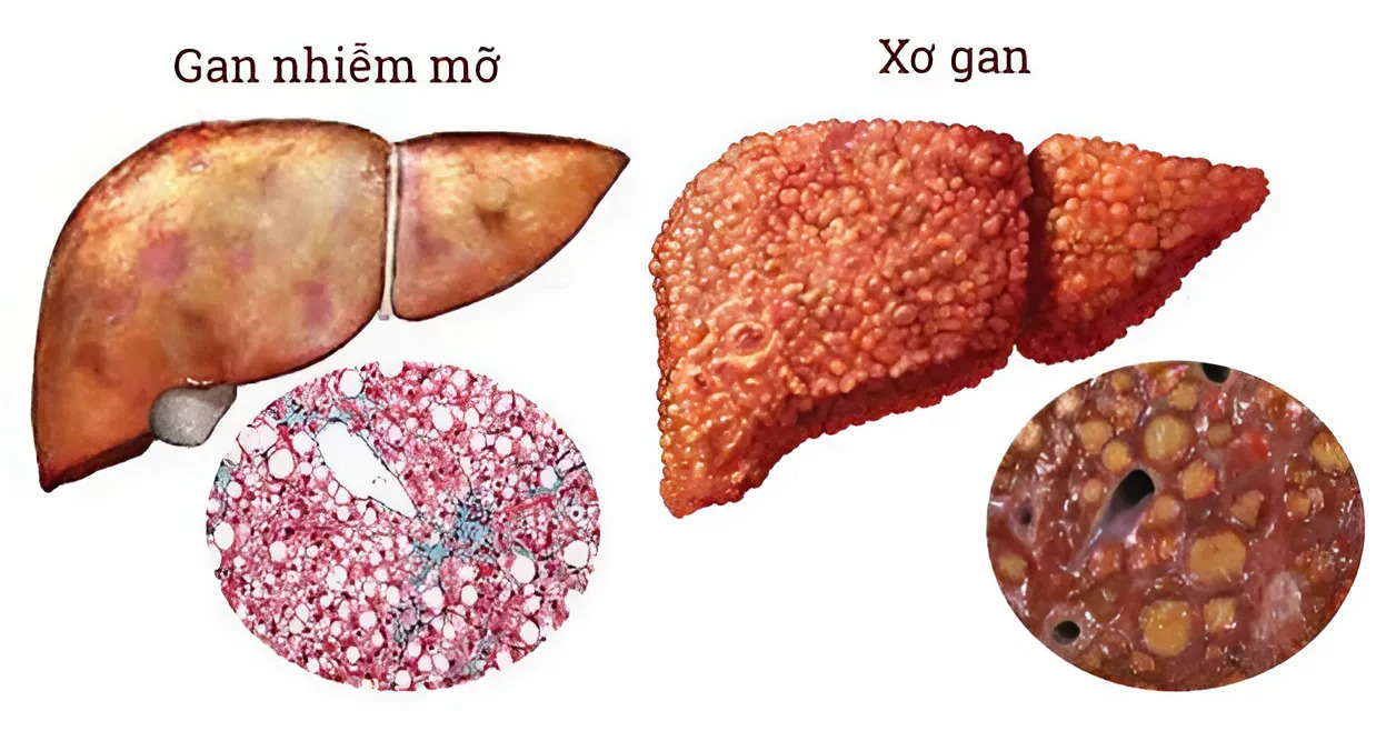 Điều hòa hệ nội tiết về gan