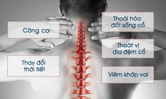Nguyên Nhân Gây Đau Cổ Vai Gáy Ở Nhiều Độ Tuổi Khác Nhau