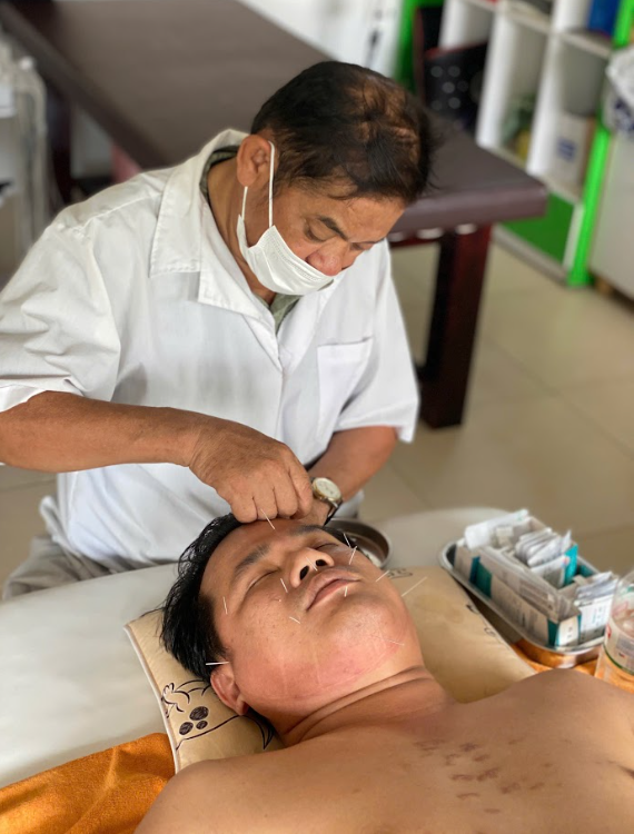 Phương pháp Châm Cứu - cân bằng khí huyết, giảm đau tự nhiên